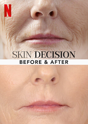 Skin Decision: Before and After